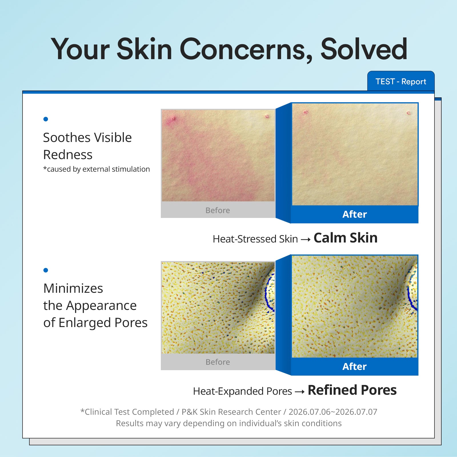 Icy Cooling Patch